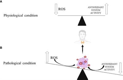 The protective role of nutritional antioxidants against oxidative stress in thyroid disorders